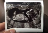 Koh Samui Honeymoon Our Unexpected Souvenir