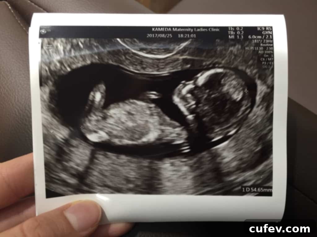 Pregnant woman's belly, announcing exciting news during her Koh Samui honeymoon